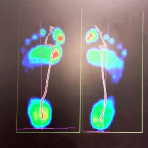 scan image of a pair of feet showing pressure points